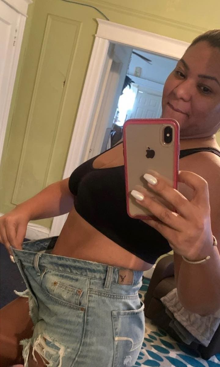 After Medical Weight Loss at Nuluk Aesthetics