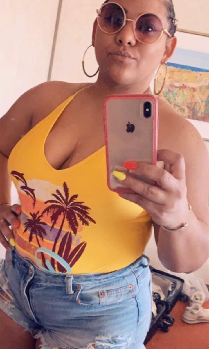 Before Medical Weight Loss at Nuluk Aesthetics