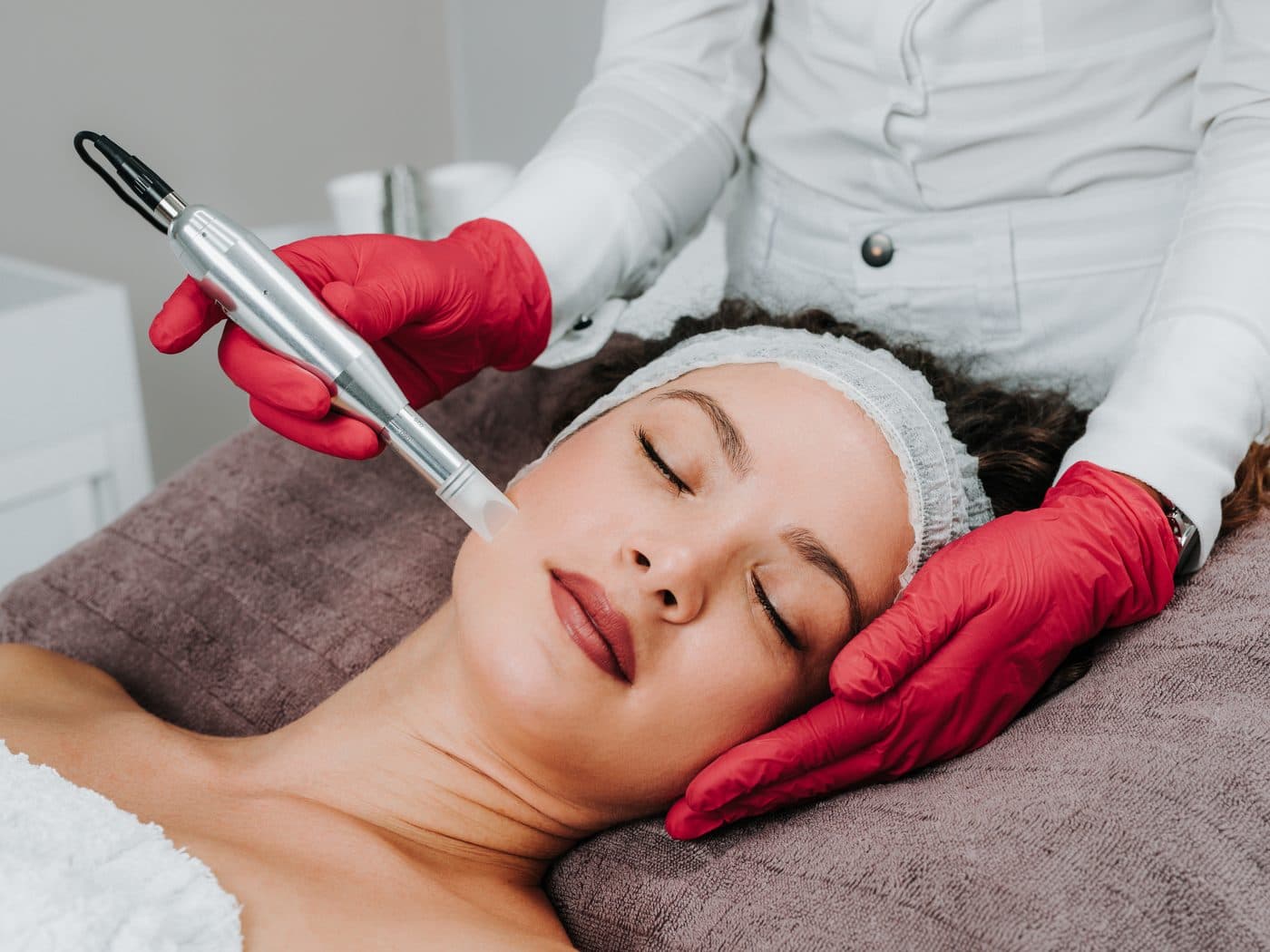 Microneedling