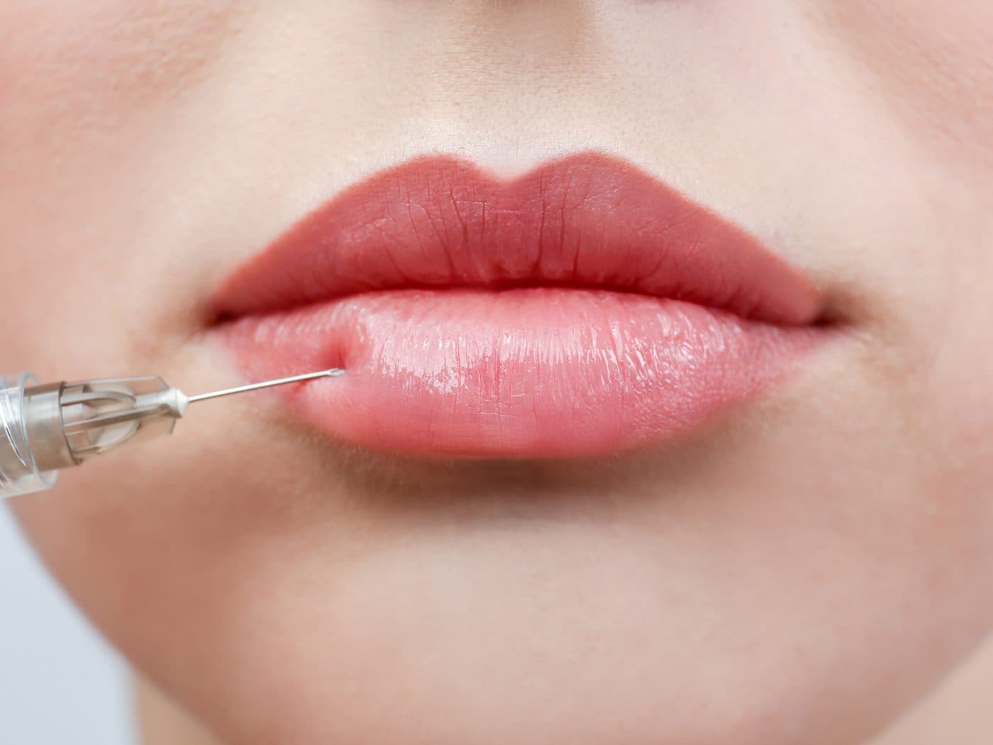 Injectables